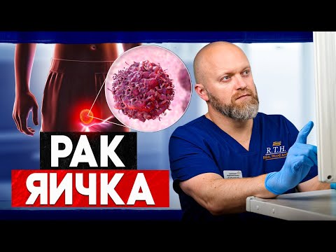 РАК яичка: уплотнение, опухоль, увеличение или отек яичка. Красные флаги рака