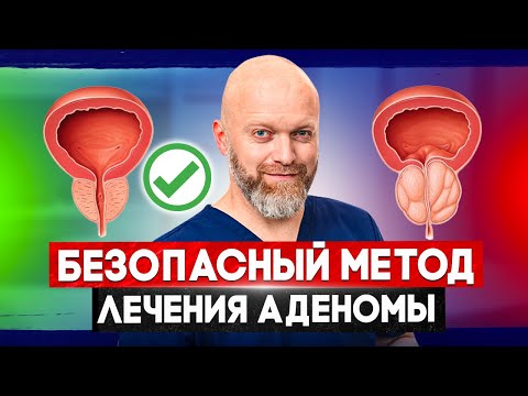 Безопасный метод лечения аденомы простаты. Водно-паровая термотерапия на аппарате REZUM