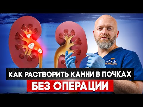 Эндоскопическое удаление крупных камней мочевого пузыря без разрезов