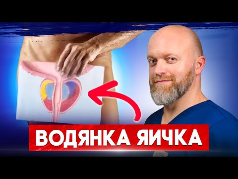 Опухло яичко - как лечить? Водянка яичка: ошибка, которая стоит дорого